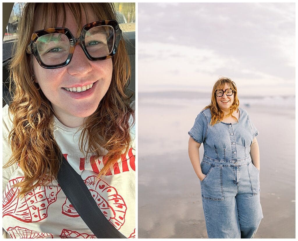 four months post botox