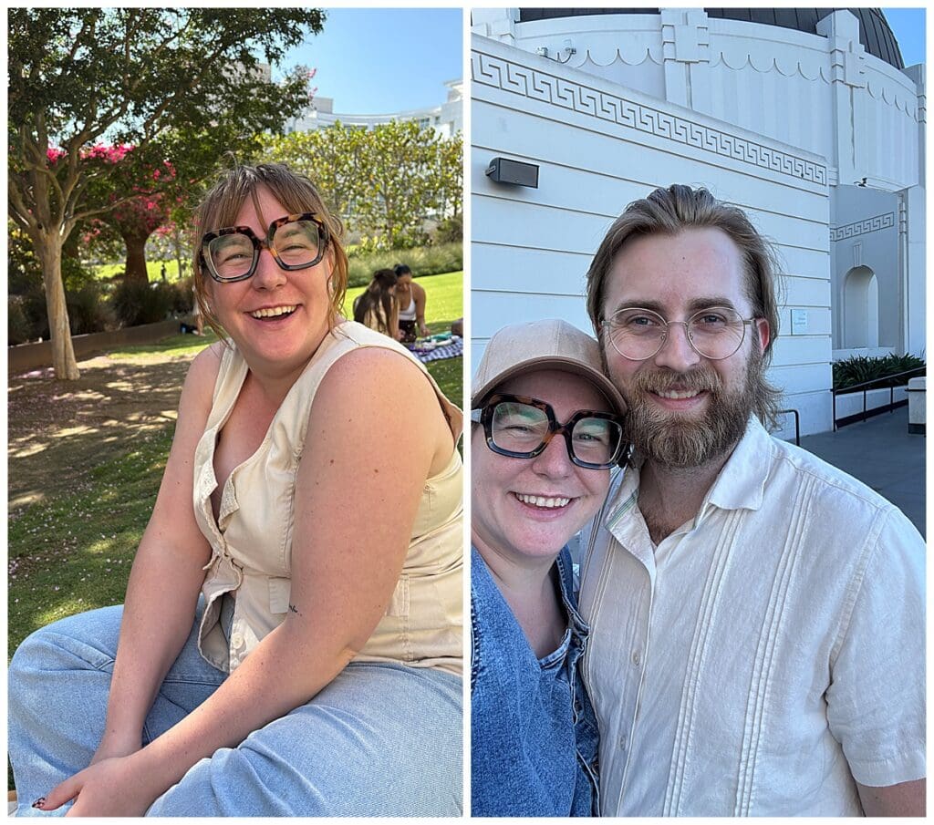 two months post botox